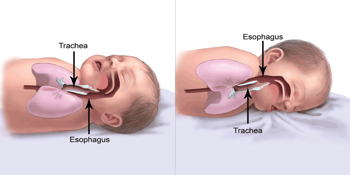 baby_anatomy