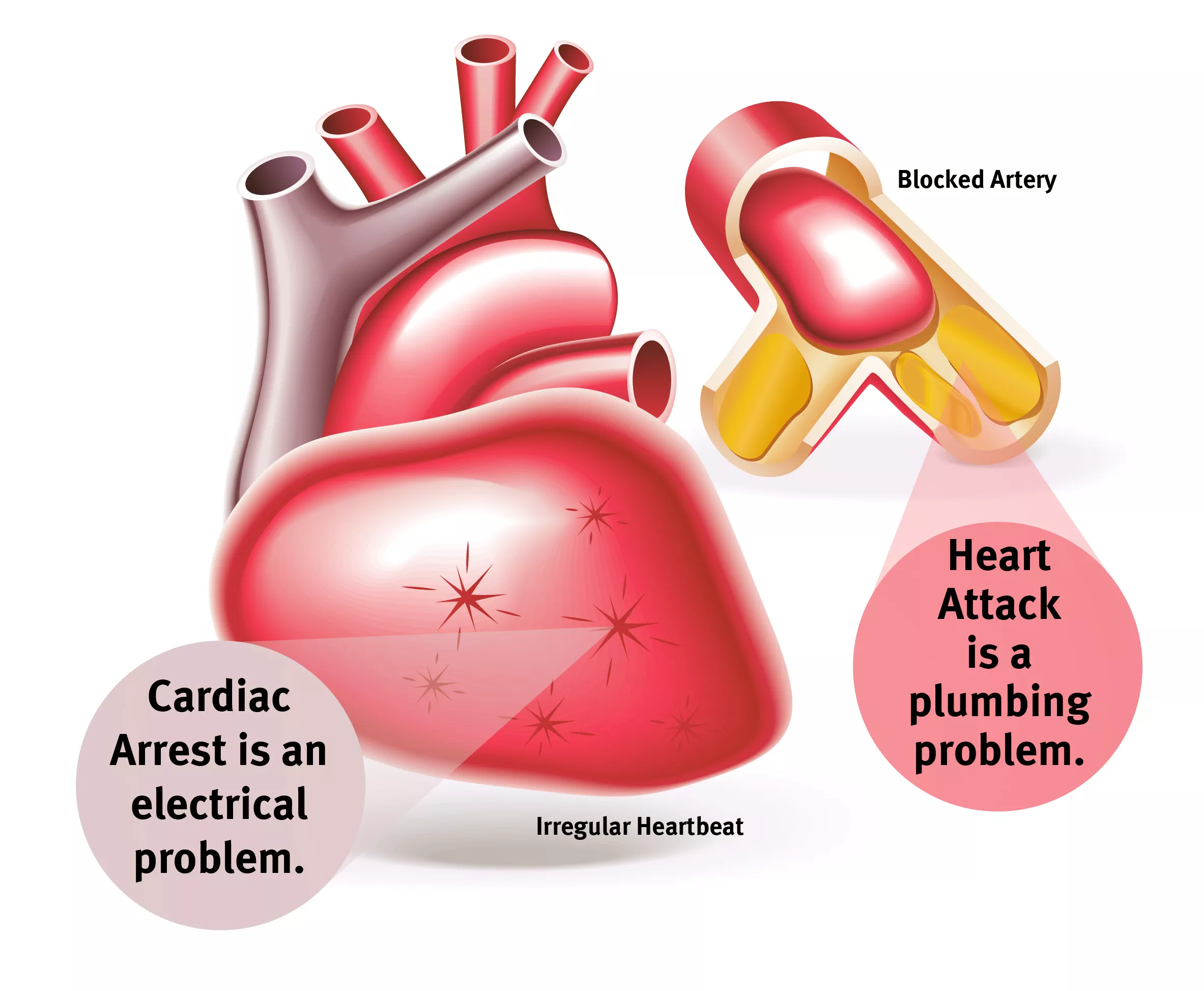 Heart Aattack vs Cardiac Arrest